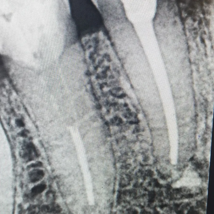دواتر